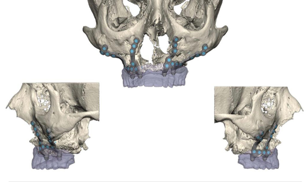 Dra. Julia Blasco Palacio