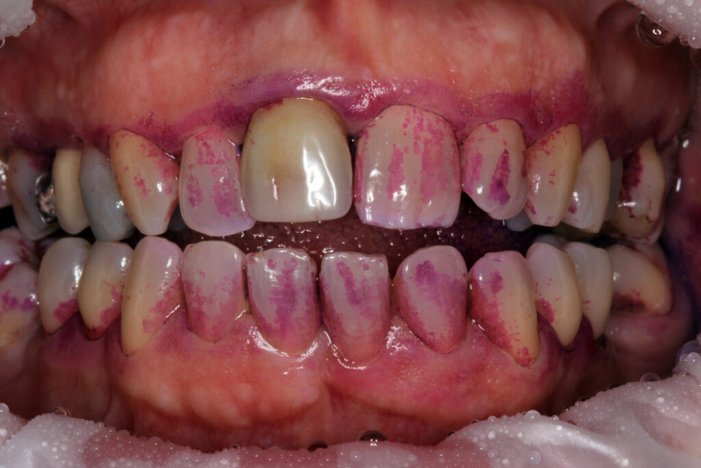 Itziar Giménez Atrián