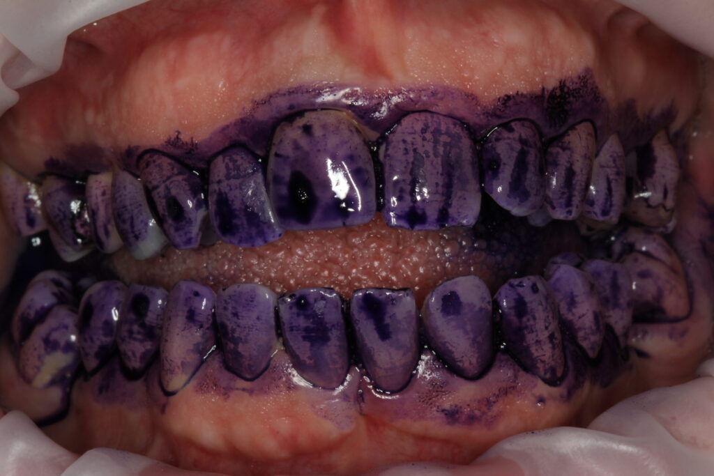 Itziar Giménez Atrián